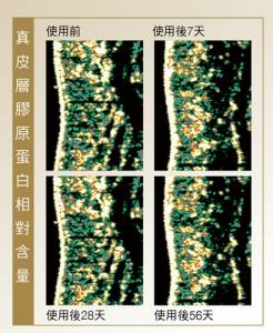 讓醫美效果更持續！ 鑽石微粒玻尿酸術後60天關鍵報告