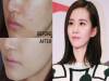 每次遮痘痘都厚厚一層粉在臉上！教你畫出女星般的「無瑕光澤」底妝