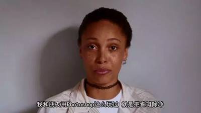 全球第一超模，竟是光頭 雀斑女孩？她被罵「醜陋」一度自殺，如今活出真正的美