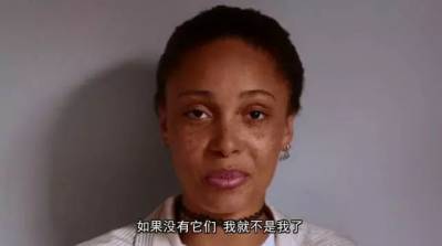 全球第一超模，竟是光頭 雀斑女孩？她被罵「醜陋」一度自殺，如今活出真正的美