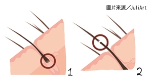 搶救髮量大作戰