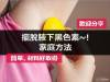 小姐您腋下如何 教你擺脫腋下小黑頭，材料簡單好取得~