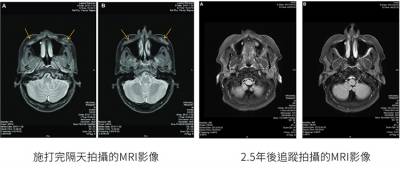 晶亮瓷非等同「骨粉」 破除疑慮安心變美