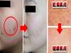日本女孩最近流行一種保養法，不用花大錢，卻可以讓痘痘少了 黑眼圈沒了 水腫也消了