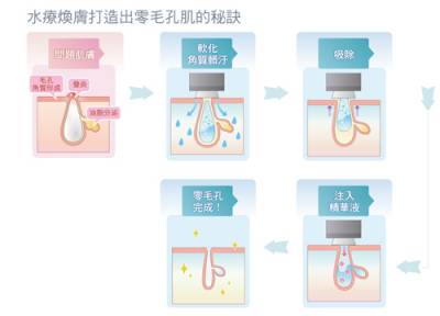 鼻頭黑點太搶戲 還我乾淨漂漂鼻 Q-touch水療煥膚 美肌保養第一步