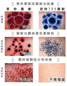 「皮秒755蜂巢雷射」黑色素瞬間潰散 給肌膚魔法般煥新感受